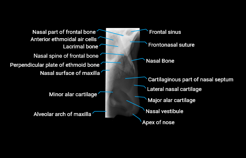 X ray nasal bone lateral labelled anatomy image.png